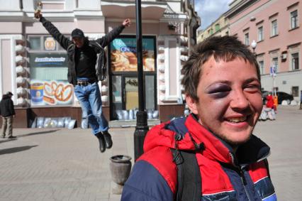 Молодой человек с синяком под глазом  на Старом Арбате в Москве.