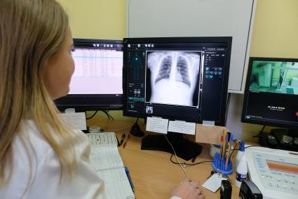 Санкт-Петербург. Медицинский работник смотрит на рентгеновский снимок легких в отделении Клинической инфекционной больницы имени С. П. Боткина.