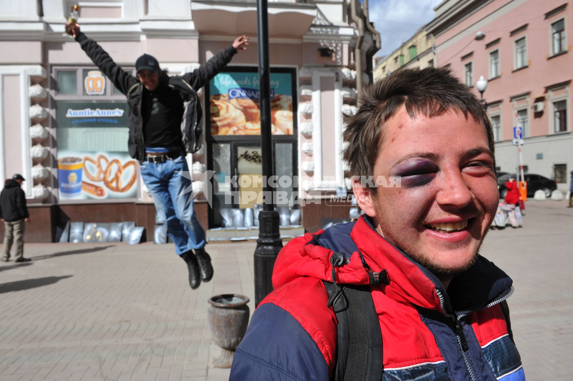 Молодой человек с синяком под глазом  на Старом Арбате в Москве.