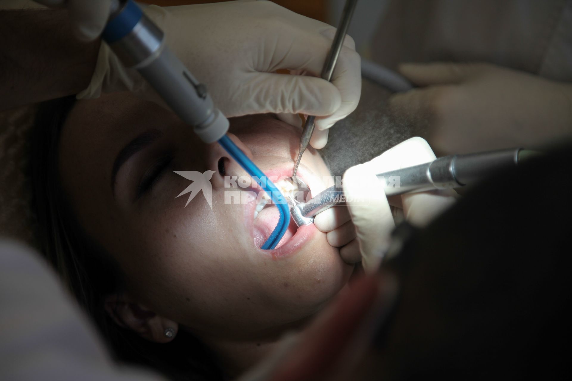 Ставрополь. Девушка на приеме у стоматолога.