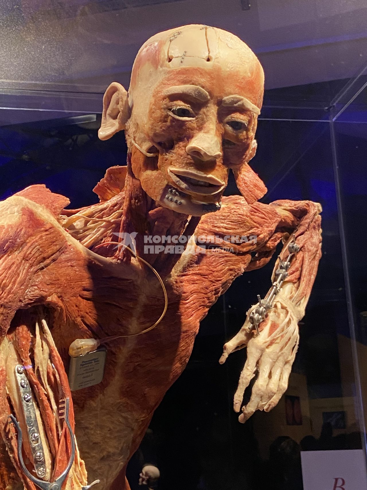 ВДНХ. Выставка BODY WORLDS. 2021